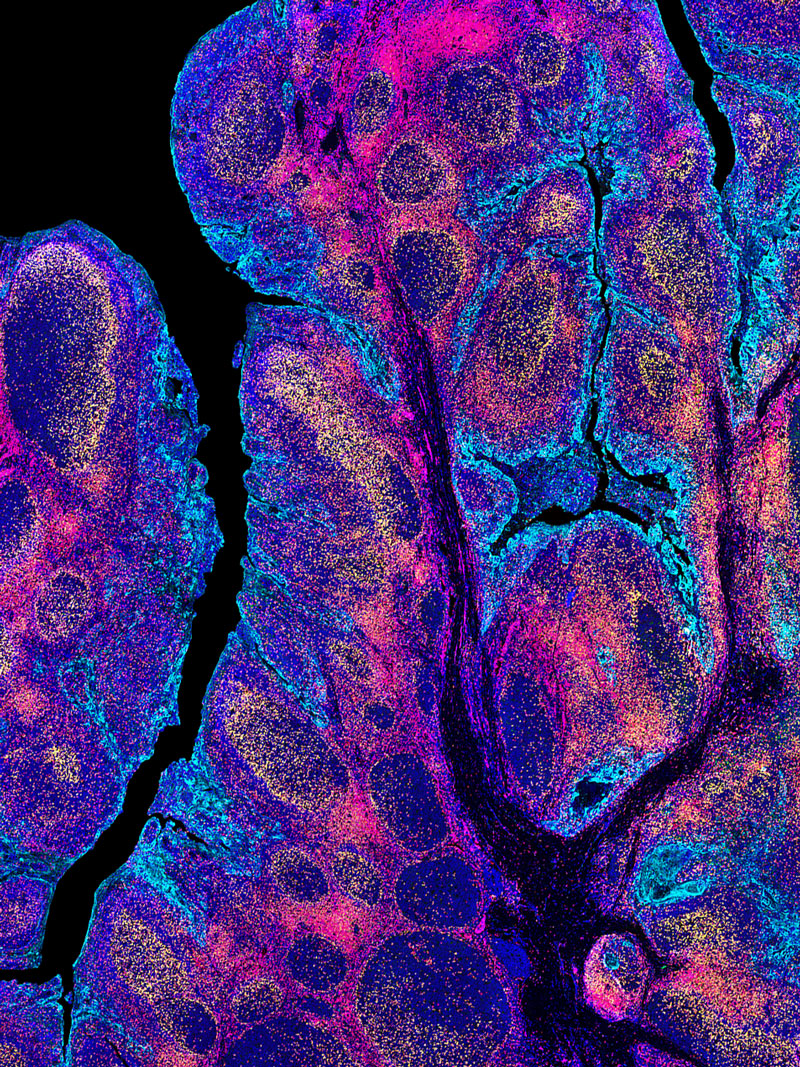 Phenotyping and imaging of the tumor  microenvironment using FlexVUE™