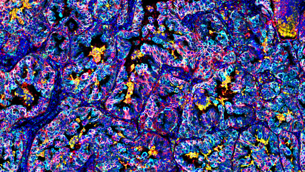 OmniVUE™ PD-L1 panel (non-small cell lung cancer)