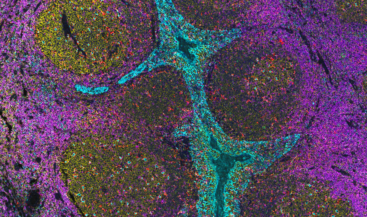 Sample standardized tissue multiplexing